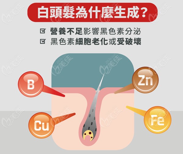 白头发生成原因