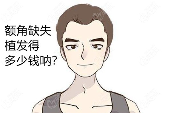 男士种头发植2个额角的价格
