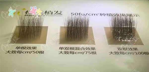 植发密度不同呈现的视觉结果不同哒