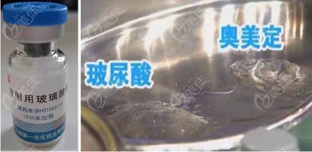 玻尿酸和奥美定样子对比图片