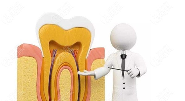 牙齿要做根管治疗的图