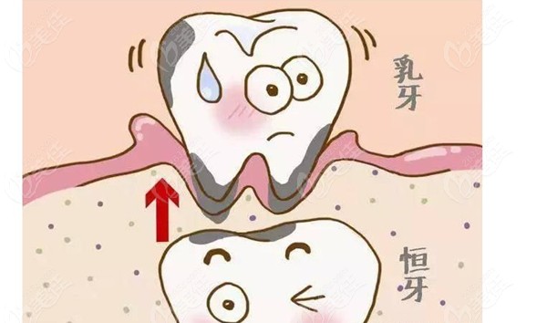 乳牙跟恒牙的关系