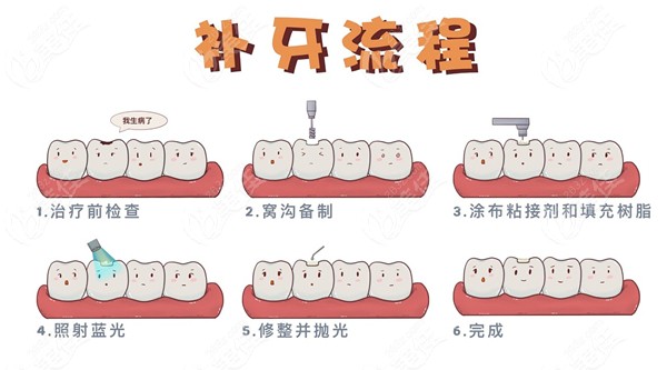 详解补牙流程图