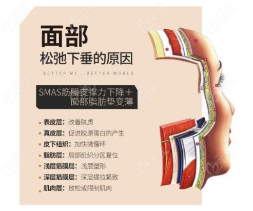 面部松弛下垂的原因是筋膜层松弛了