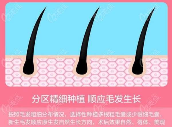 济宁韩美植发的特色
