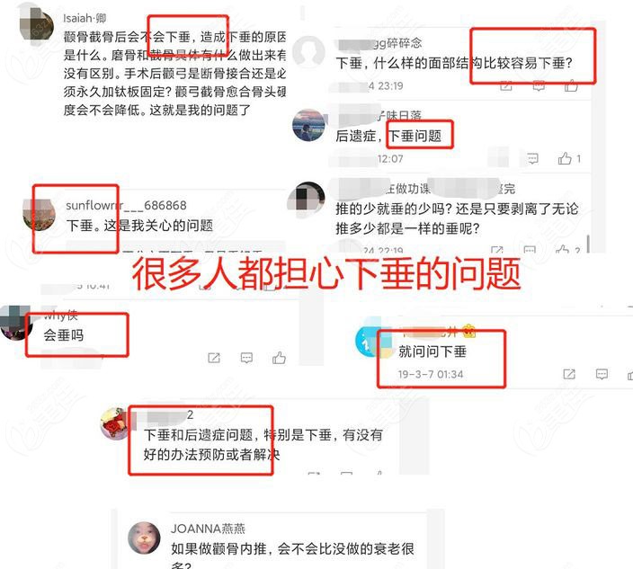 很多人擔(dān)心做完顴骨內(nèi)推臉部下垂怎么辦 很多人擔(dān)心做完顴骨內(nèi)推臉部下垂怎么辦