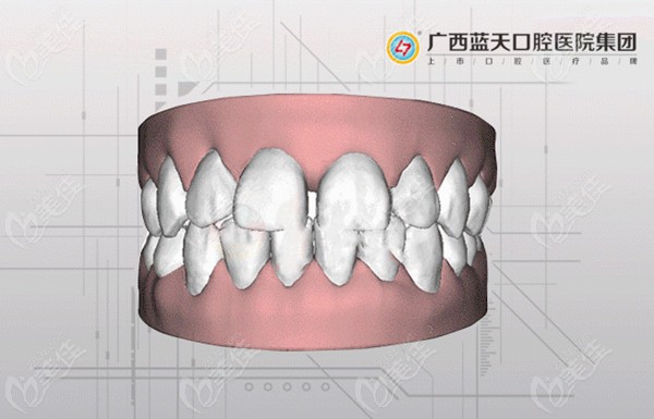 蓝天口腔矫正牙齿优势