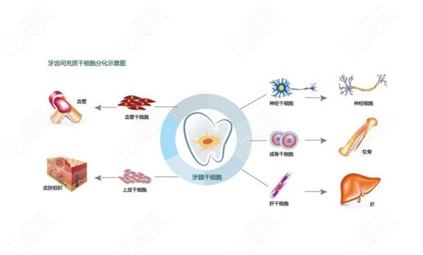 牙髓再生术的费用