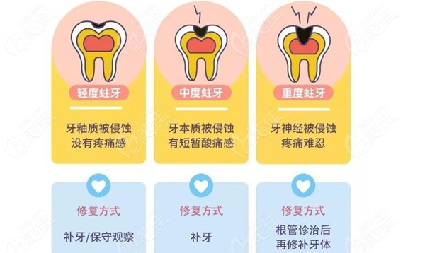 补牙的流程及步骤图片图片