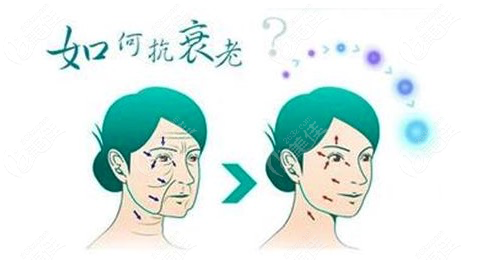 筋膜悬吊多久做第二次呢？