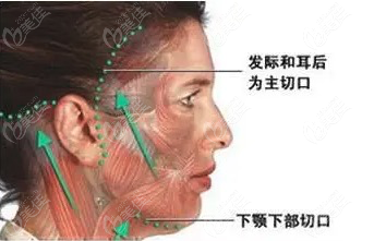 颈部拉皮手术多少钱做一次呢？