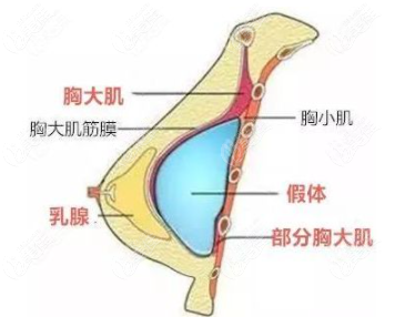 從石家莊蘇亞美聯臣隆胸好的醫生介紹中瞭解他們做傲諾拉假體豐胸怎麼