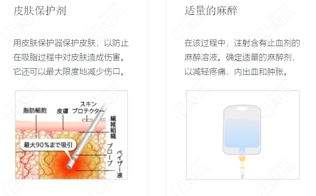 日本吸脂手术优势