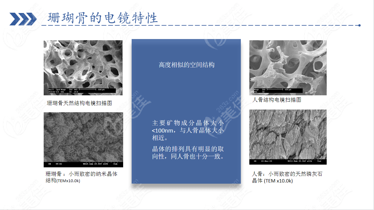 珊瑚骨和人体骨骼在电镜下的原理相似