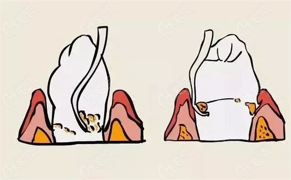 菏澤華忠口腔醫(yī)院補貼報銷政策