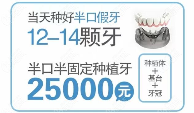 来马鞍山万诺口腔做半口半固定种植牙价格在25000元起活动海报五