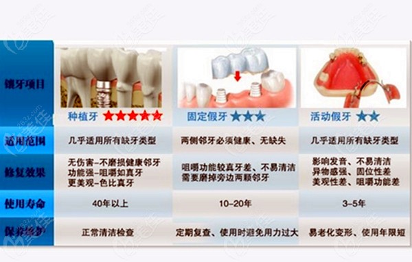 牙间距太小不能种植牙怎么办除了只能镶牙外其实还能