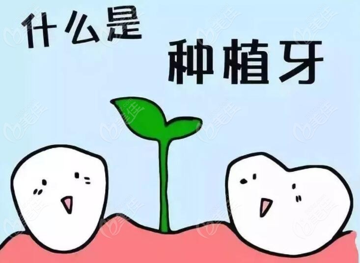 什么是种植牙呢