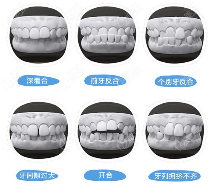 牙一生口腔诊疗项目