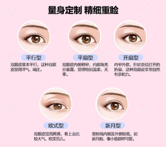 太原华美张鹏云医生做全切双眼皮的5种形状