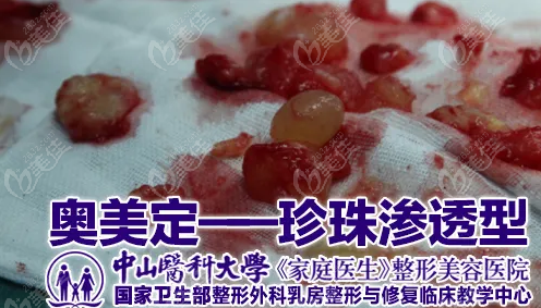 额头异物取出哪个医生好