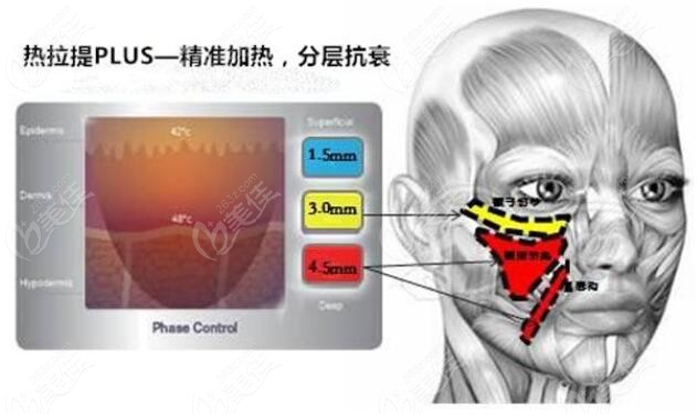 热拉提plus治疗原理