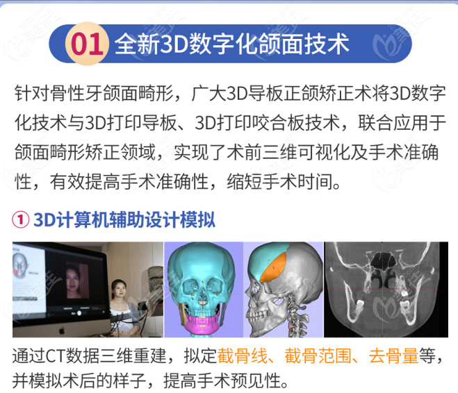 广州广大何锦泉3d数字化正颌技术成熟