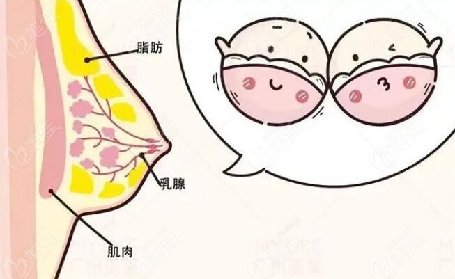 乳腺胸和脂肪胸区分图图片