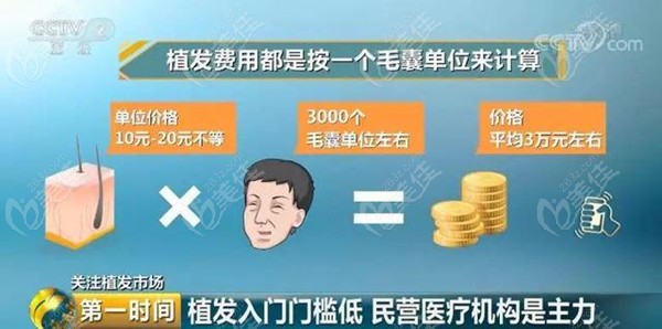 <!--<i data=20240703-sp></i>-->微针植发价格计算方式