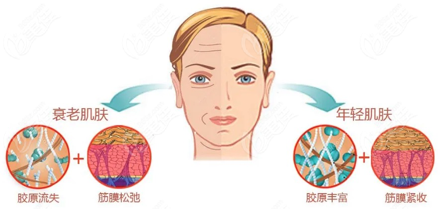 面部衰老过程