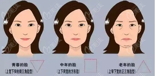 不同年龄段出现的衰老问题