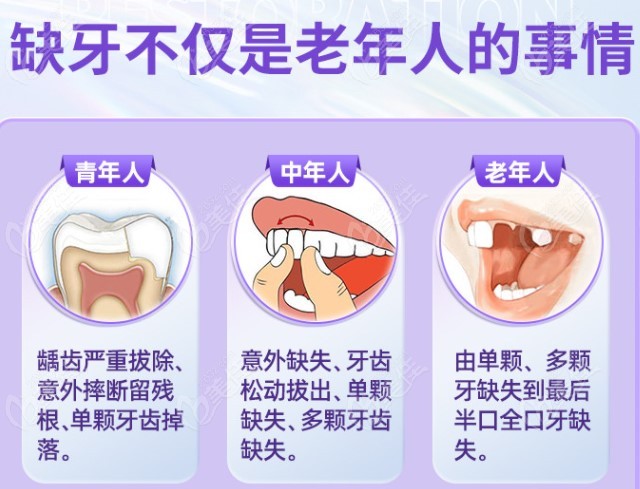 常见的缺牙人群及缺牙情况