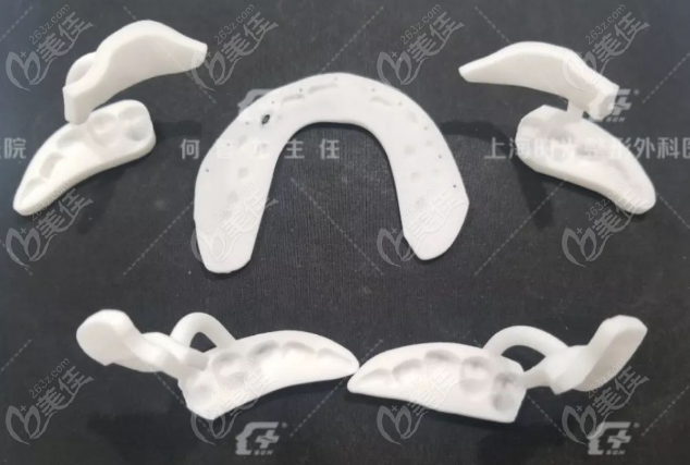 3D打印正颌导板