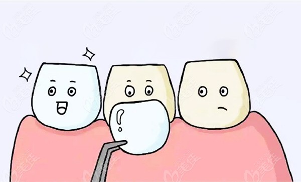 牙大夫口腔牙齿修复的费用