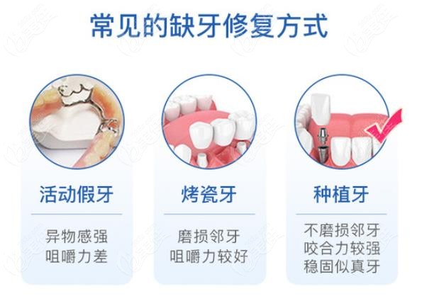 德美口腔常用的牙齿缺失修复方式