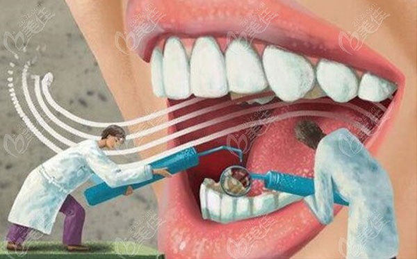 全瓷牙是牙齿修复的好助手