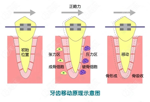 淄博壹美口腔牙齿移动