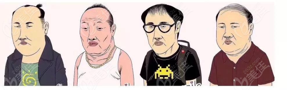 密度是决定植发后的成效