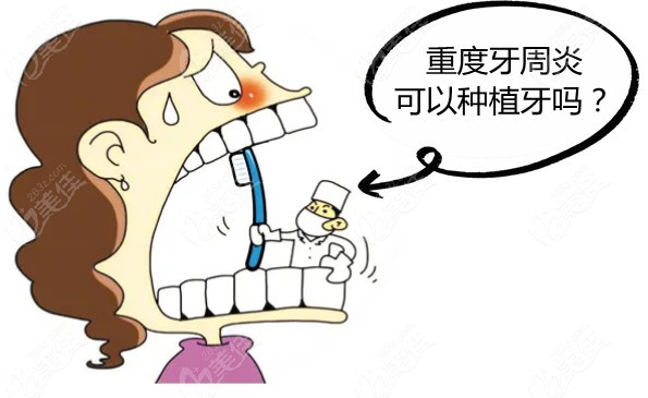 重度牙周炎可以种植牙吗