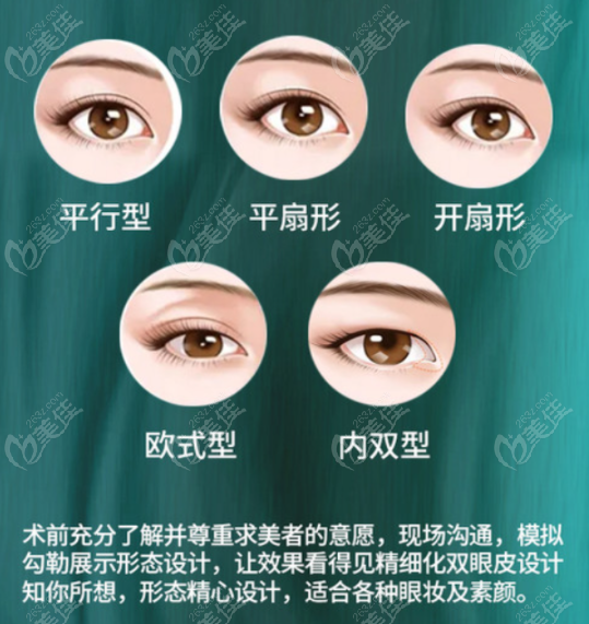 周著祖医生能做的眼部类型