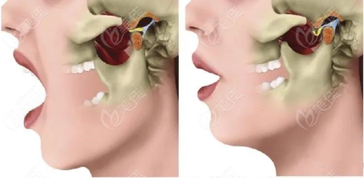 谁让杭州达仑口腔方朝荣院长做过正畸方院长矫正牙齿需要多少钱
