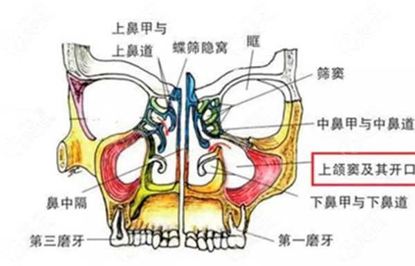 上颌窦及其开口的解剖图