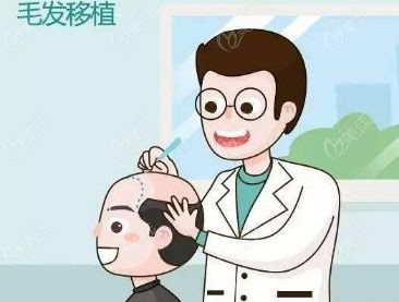 张鹏医生的植发技术优势有哪些