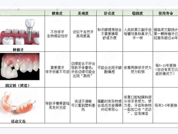 种植牙、固定义齿等的对比