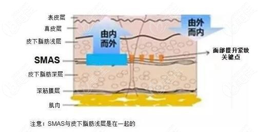 5D超声炮原理