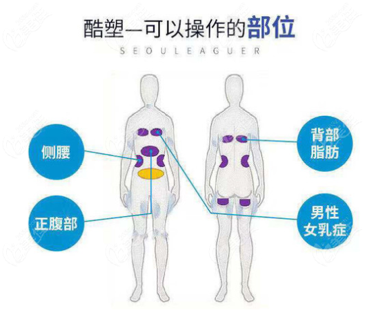 酷塑冷冻溶脂可操作的部位