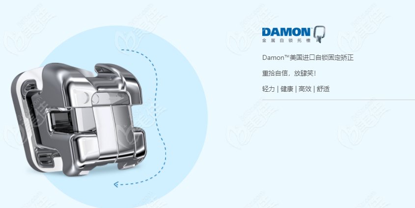 Damon金属自锁牙套的详细介绍