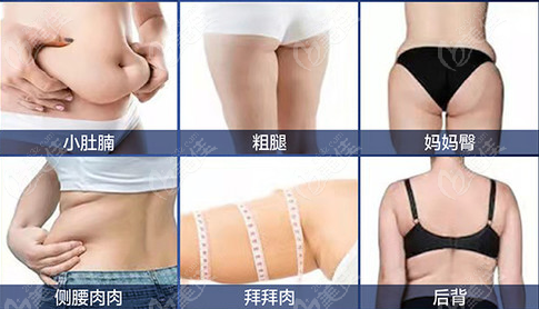 昆明好的全身吸脂医院排名