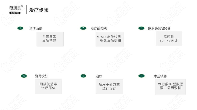 薇旖美胶原蛋白治疗步骤图解