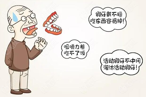 活动假牙缺点
